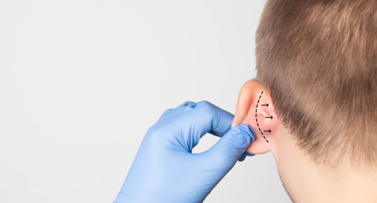 Specialista otoplastica Torino