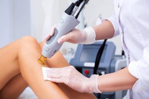 Epilazione laser definitiva funziona Milano